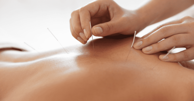 DIU Acupuncture scientifique – Médecine factuelle et pratique : durée, programme…