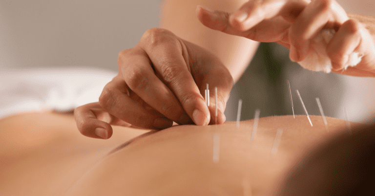 Diplôme d’État Capacité en Acupuncture : durée, accès, programme…