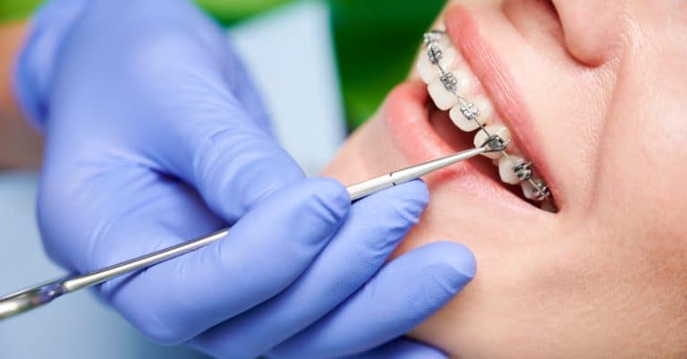 DES en orthodontie : durée, accès, programme et débouchés